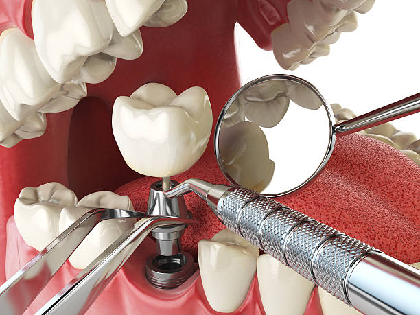 Best Emergency Dental Services for Seniors in Eddystone, PA